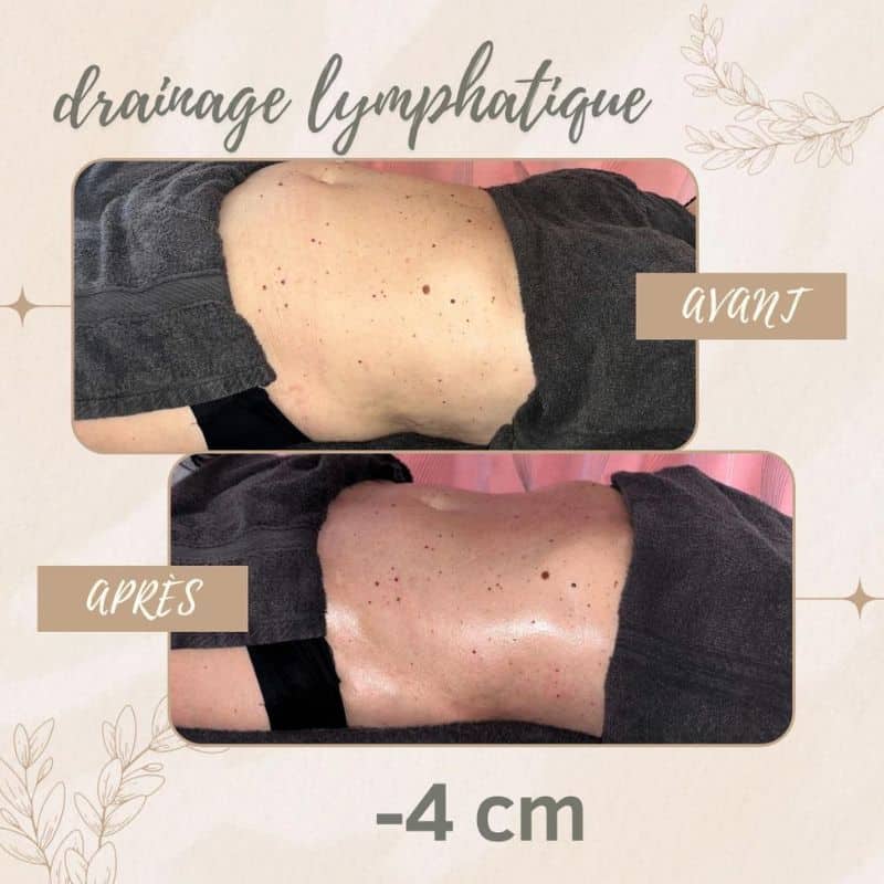 transformation avant et après un massage drainage lymphatique